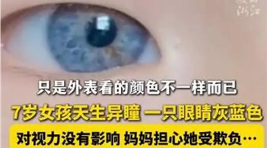 江西7岁女孩天生异瞳受到同学喜爱，医生：出现这些情况应及时治疗